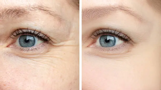 A woman with blue eyes and wrinkles on her face.