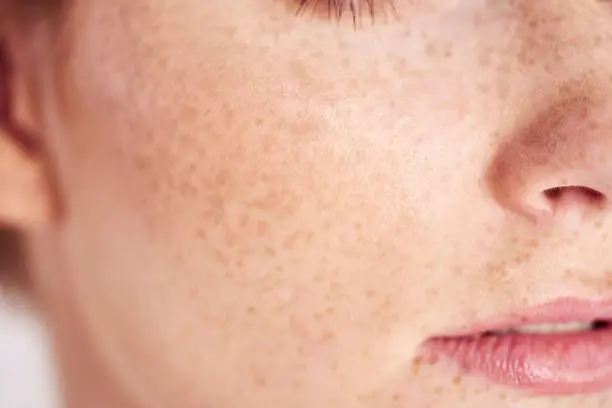 A close up of the face and neck of a person