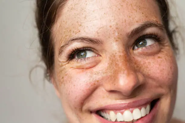 A woman with freckles smiling for the camera.