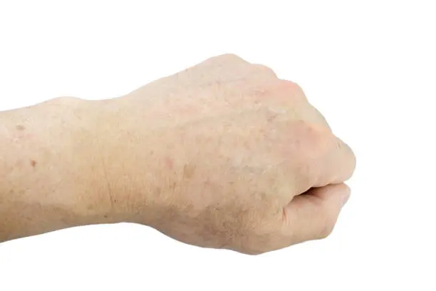 A person 's hand with white skin and brown spots.